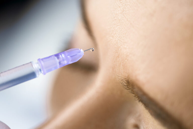 Afbeelding van behandeling Baby botox