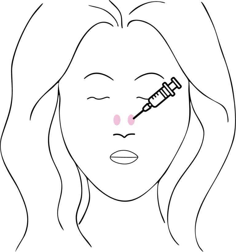 Afbeelding van behandeling Bunny lines