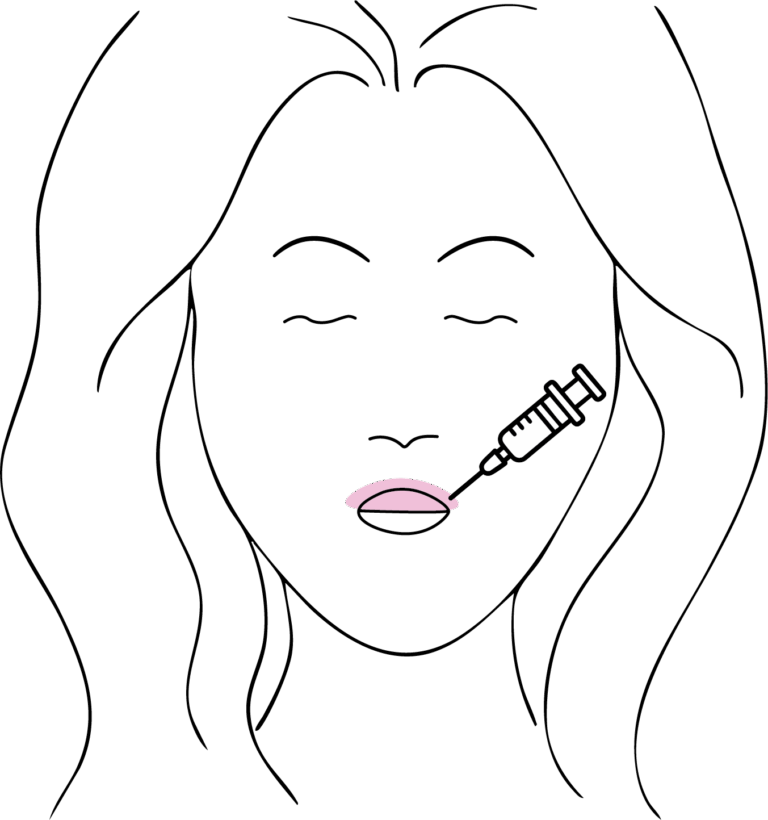 Afbeelding van behandeling Lip flip behandeling
